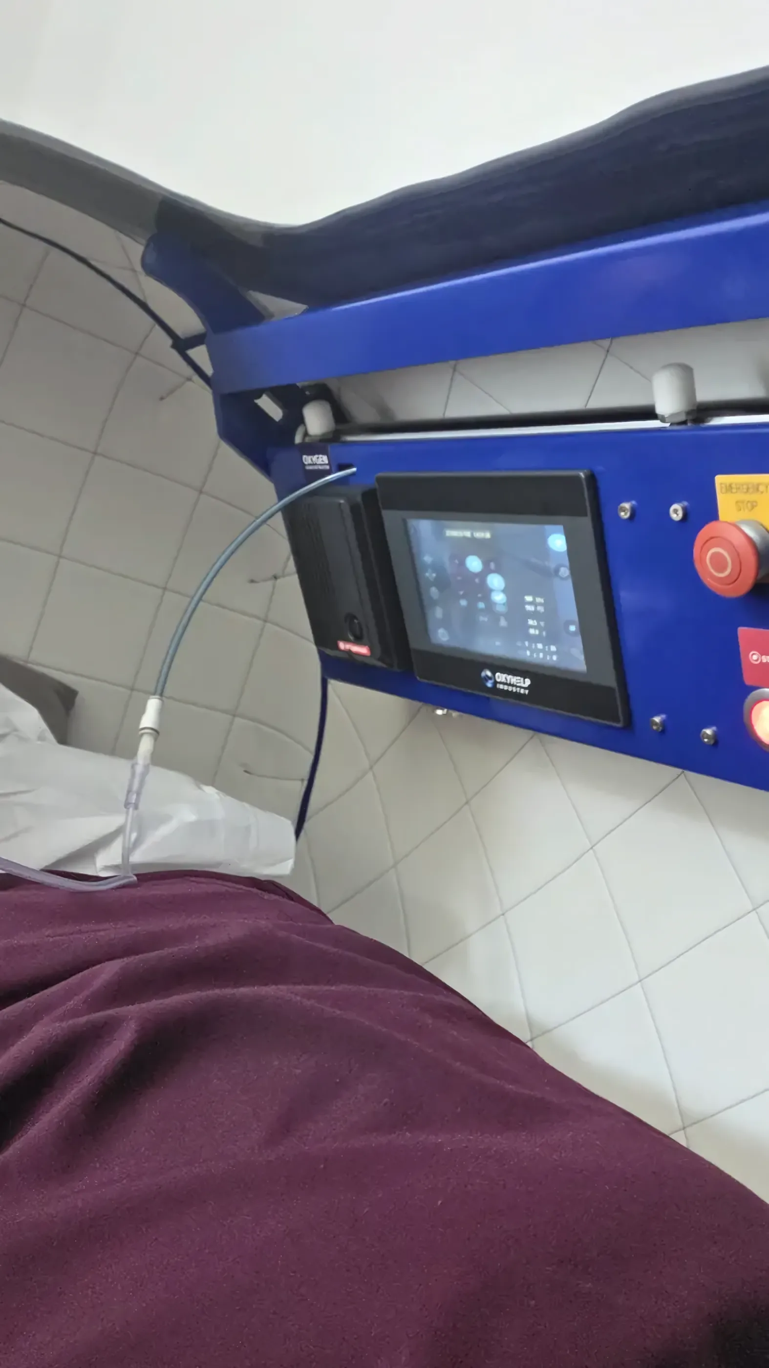 Pacientă în capsula hiperbară Oxyhelp® la CryoMedica Cluj, protocol HBOT la 2 bari, oxigen îmbogățit livrat prin mască.